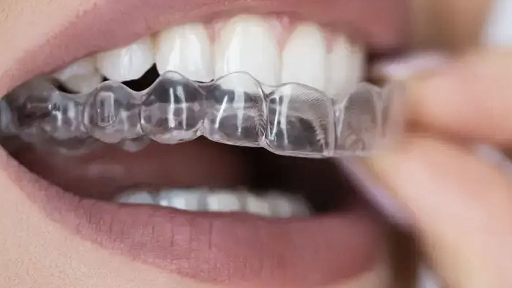 The Importance of Night Guards for Teeth Protection