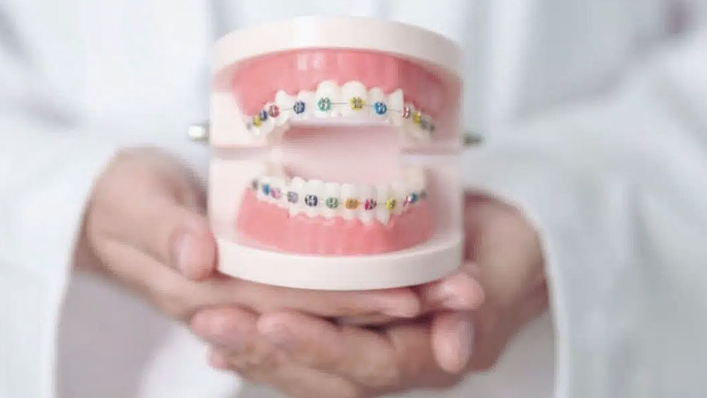 The Role of Orthodontics in Preventing Future Dental Problems